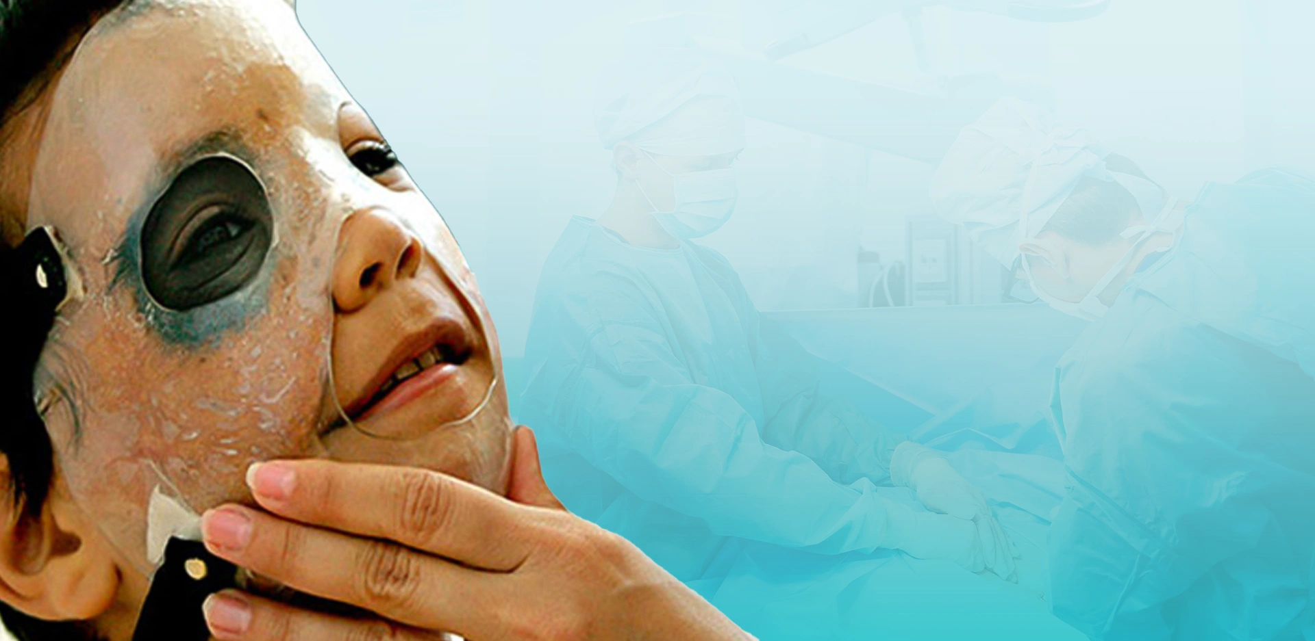 Microcirugía en quemaduras faciales